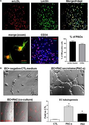 Tyrosine-Protein Phosphatase Non-receptor Type 9 (PTPN9) Negatively Regulates the Paracrine Vasoprotective Activity of Bone-Marrow Derived Pro-angiogenic Cells: Impact on Vascular Degeneration in Oxygen-Induced Retinopathy